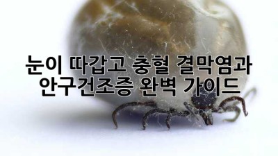 눈이 따갑고 충혈? 결막염과 안구건조증 완벽 가이드